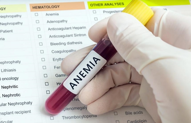 anemia-hierro